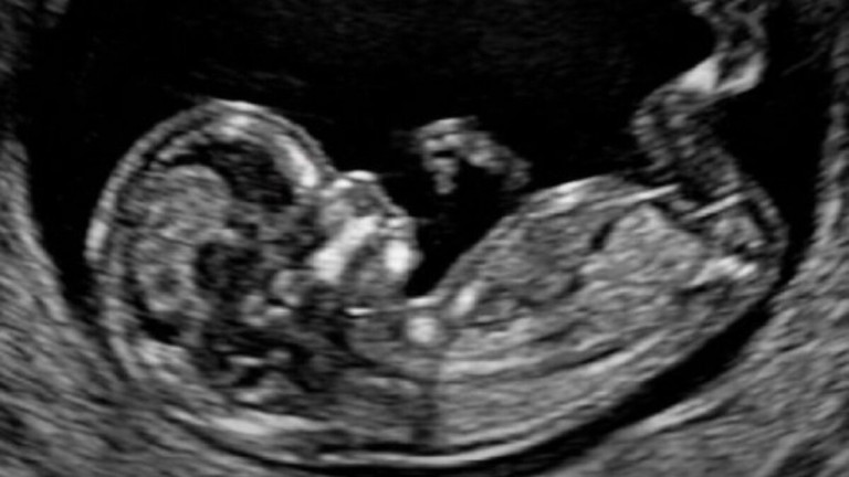 El polémico mensaje del Gobierno en defensa del «Día del Niño por Nacer»